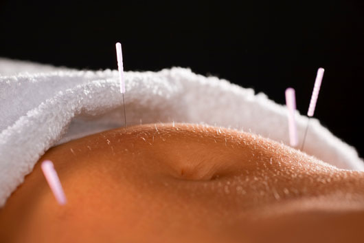 10 razones por las que la acupuntura podría ser buena para tus hijos-photo11