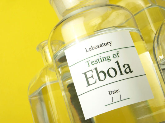 Health-First-10-Facts-you-Need-to-Know-About-the-Ebola-Virus-photo8