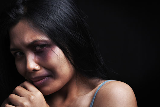 Crying-for-Help-15-Stories-About-Domestic-Abuse-that-Should-Never-Be-Forgotten-photo14