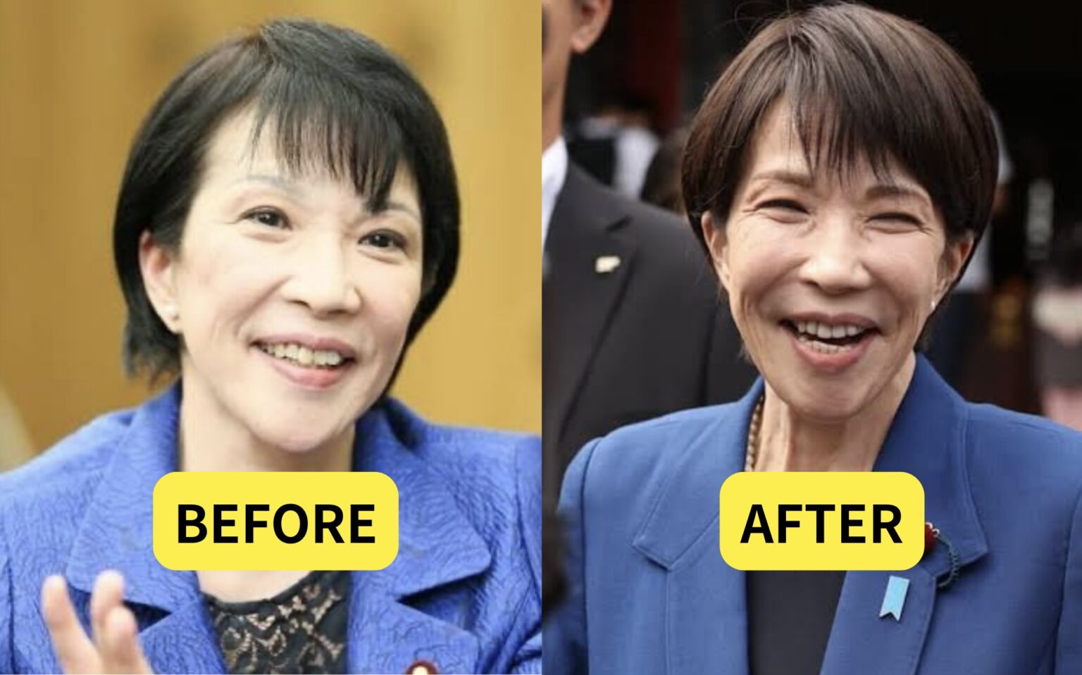 高市早苗氏の病気や持病の真相は？リウマチ闘病と現在の体調を徹底検証