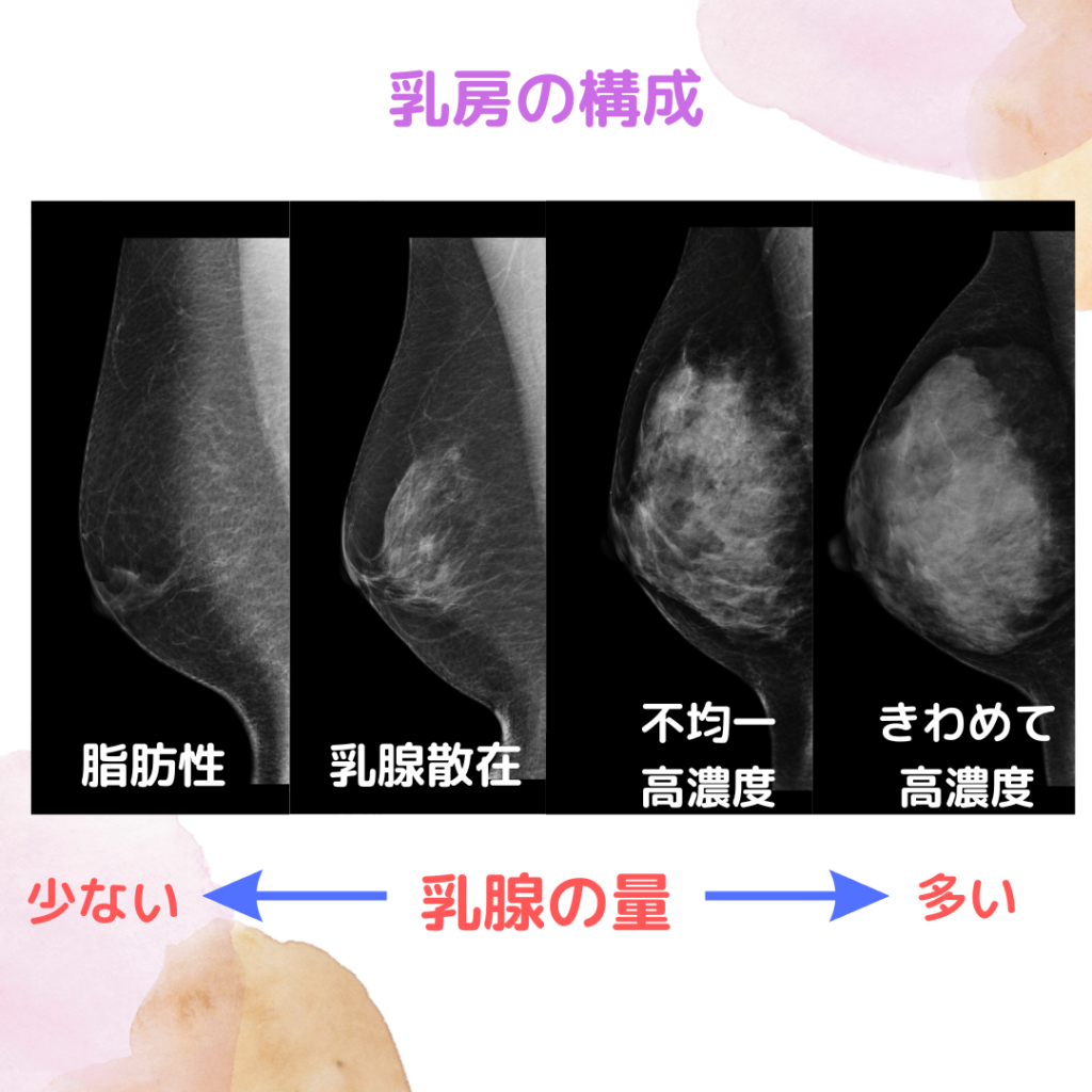 腸腰筋で見た目は激変する？ぽっこりお腹解消と姿勢改善の真実【2026】