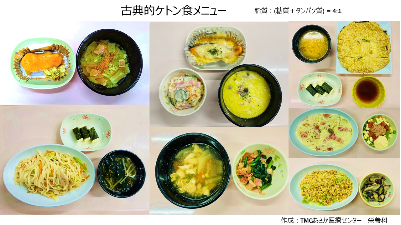 ケトン食とは？糖質制限との決定的な違いと失敗しない実践法を徹底解説