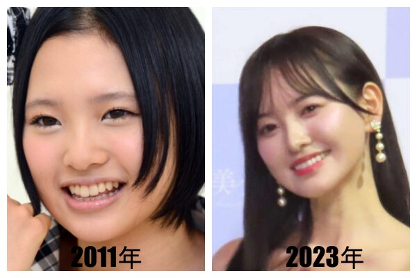 兒玉遥の整形前と現在の姿を比較！公言理由と顔の変化を徹底解説