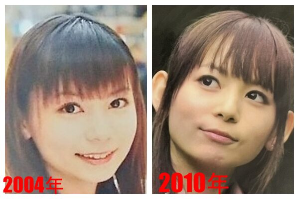 中川翔子の顔変化と整形疑惑の真相！すっぴん比較と本人の告白