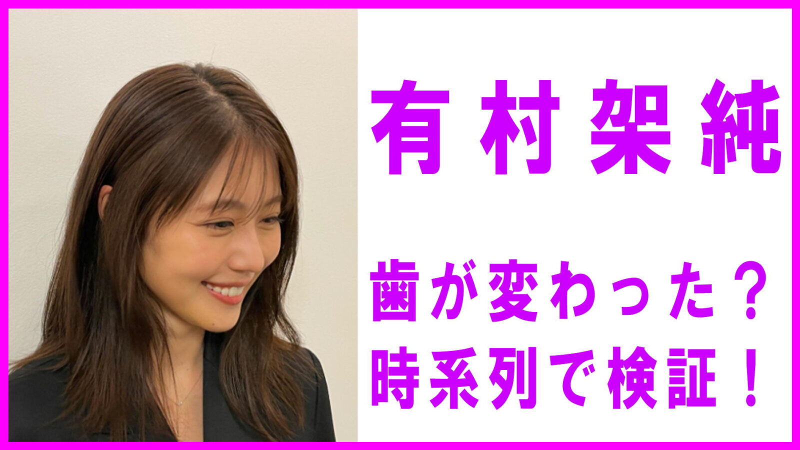 有村架純の歯並びはどう変わった？昔と現在の口元比較と治療の真相