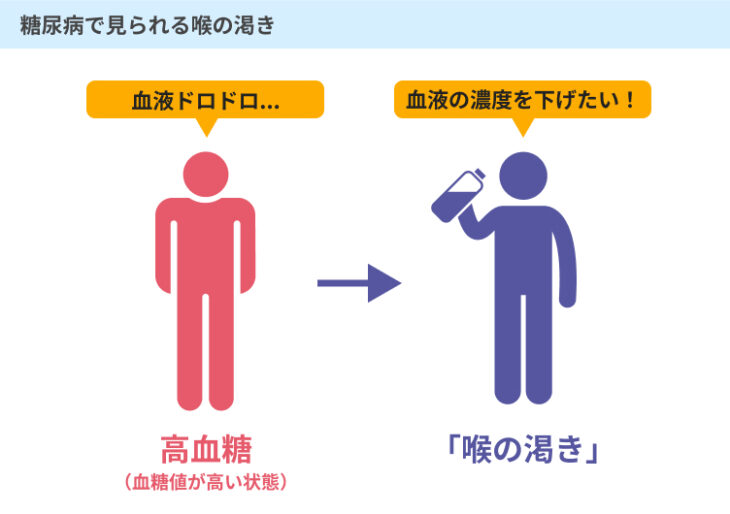 糖尿病で喉が渇くのはどのくらいから？1日3Lの危険度と初期症状