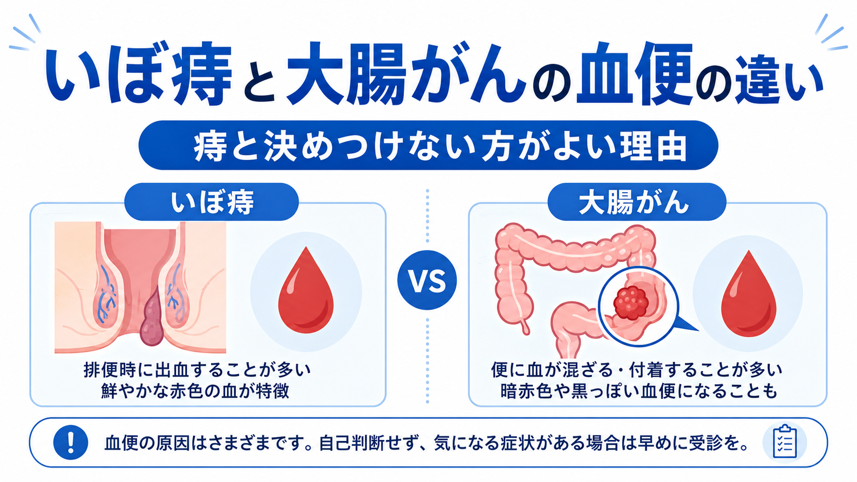 大腸がんと痔の違いとは？出血色や便の細さで見分ける命の境界線