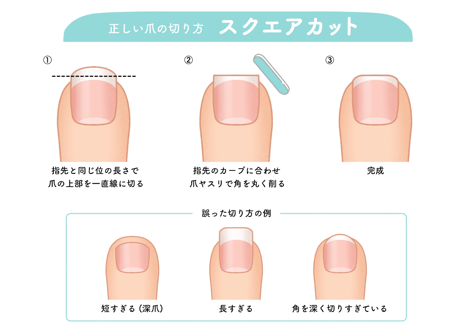 爪のスクエアカット完全ガイド｜巻き爪予防と失敗しない削り方