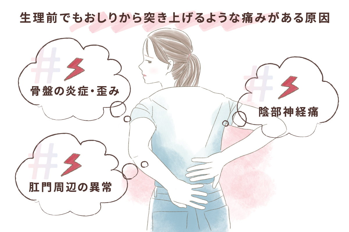 生理で腰が痛い理由と激痛の正体｜即効緩和ストレッチと受診の目安