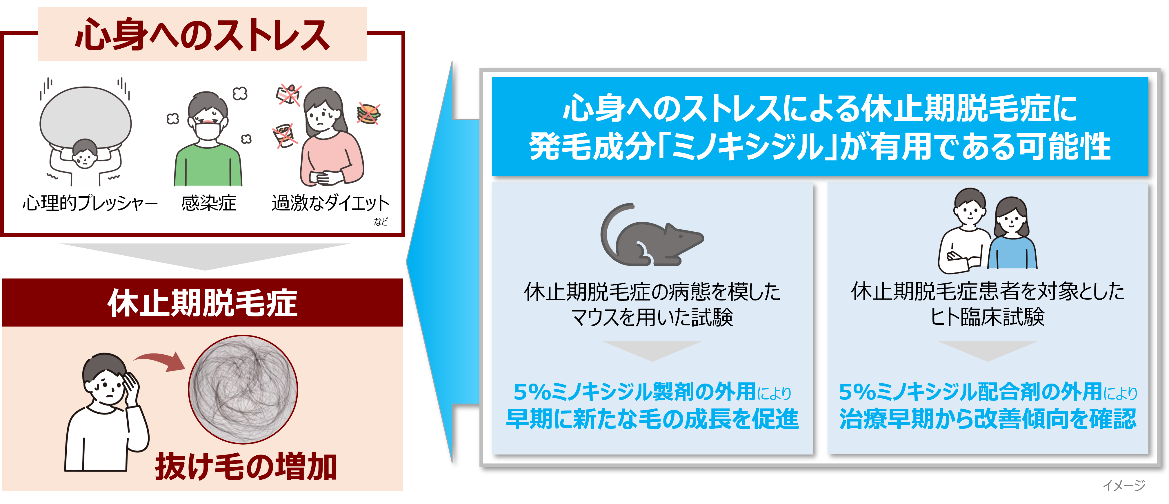 突然ごっそり抜ける髪の正体とは？休止期脱毛症の原因と治る期間