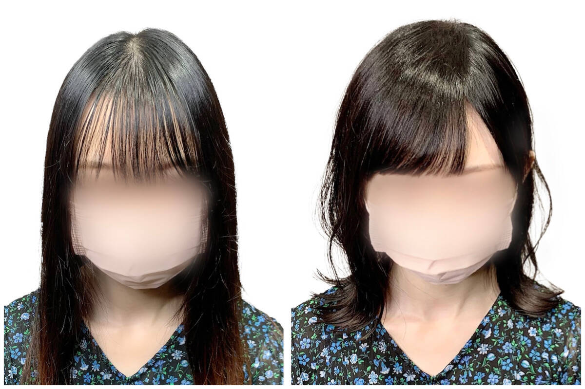 前髪の地肌が透ける女性の焦り！割れる生え際の原因と最新改善策