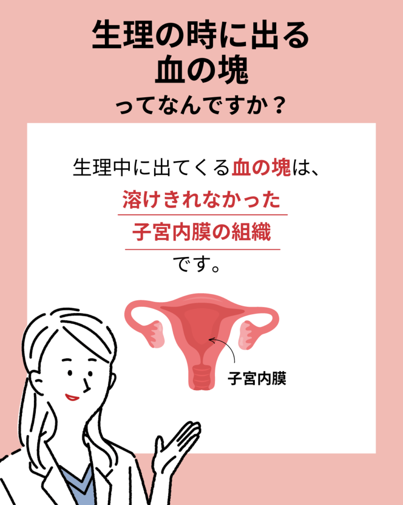 生理中の血の塊は放置Ng？レバー状の正体と見逃せない危険サイン