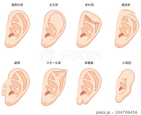 あなたの耳はどのタイプ？「耳の形の種類」が解き明かす、2026年の個人認証とオーダーメイド音響の未来