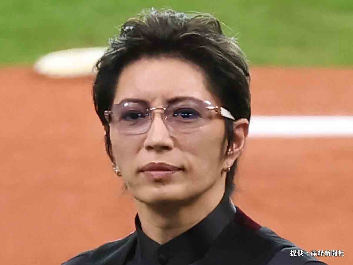 Gacktの顔は変わったのか？昔の画像比較と整形疑惑・奇跡の美貌の真相