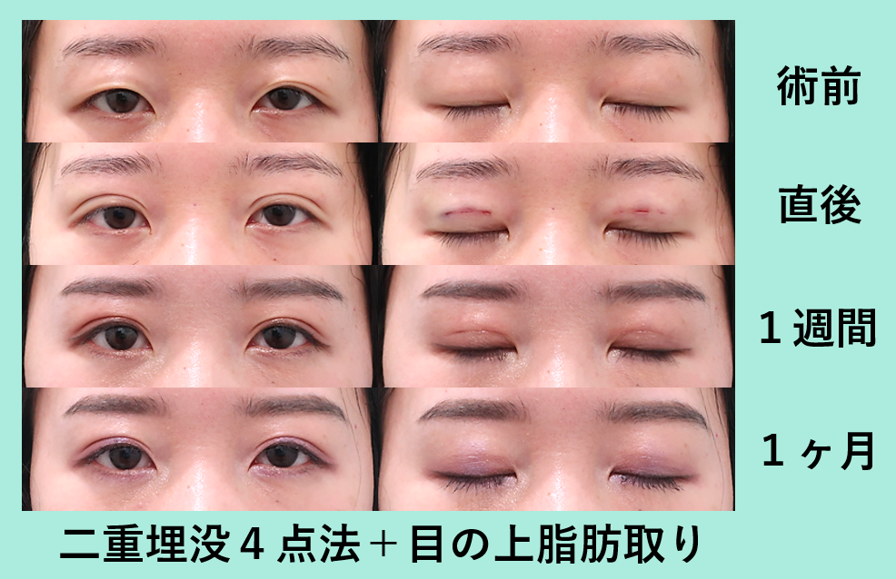 【2026年最新】平行二重の芸能人が魅せる圧倒的オーラ！理想の目元と最新美容トレンドを完全分析