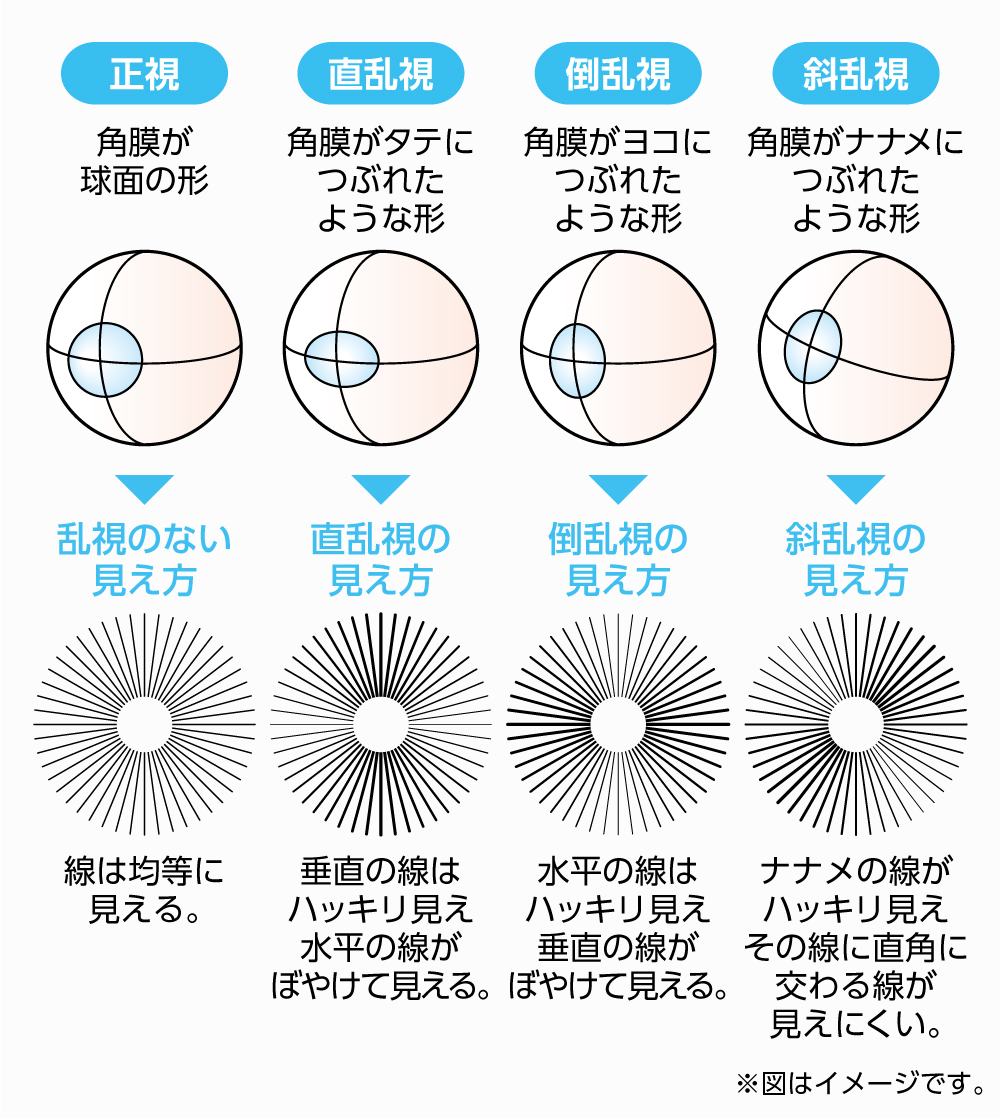 乱視の見え方を徹底検証！夜のにじみ・二重ブレの原因と2026年改善策
