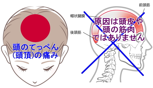 頭頂部の頭皮を触ると痛い原因とは？ピリピリ違和感の正体と受診の目安