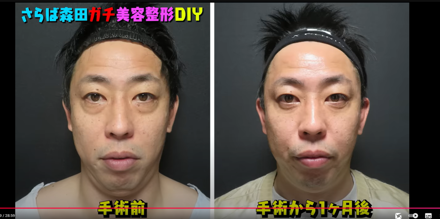 クマがひどい芸能人の裏事情！多忙な撮影と疲労の真相を徹底追跡