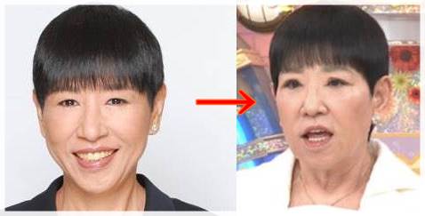 【プロフィール】 和田 アキ子 眼瞼 下垂 最新ライブ＆イベント情報 #726