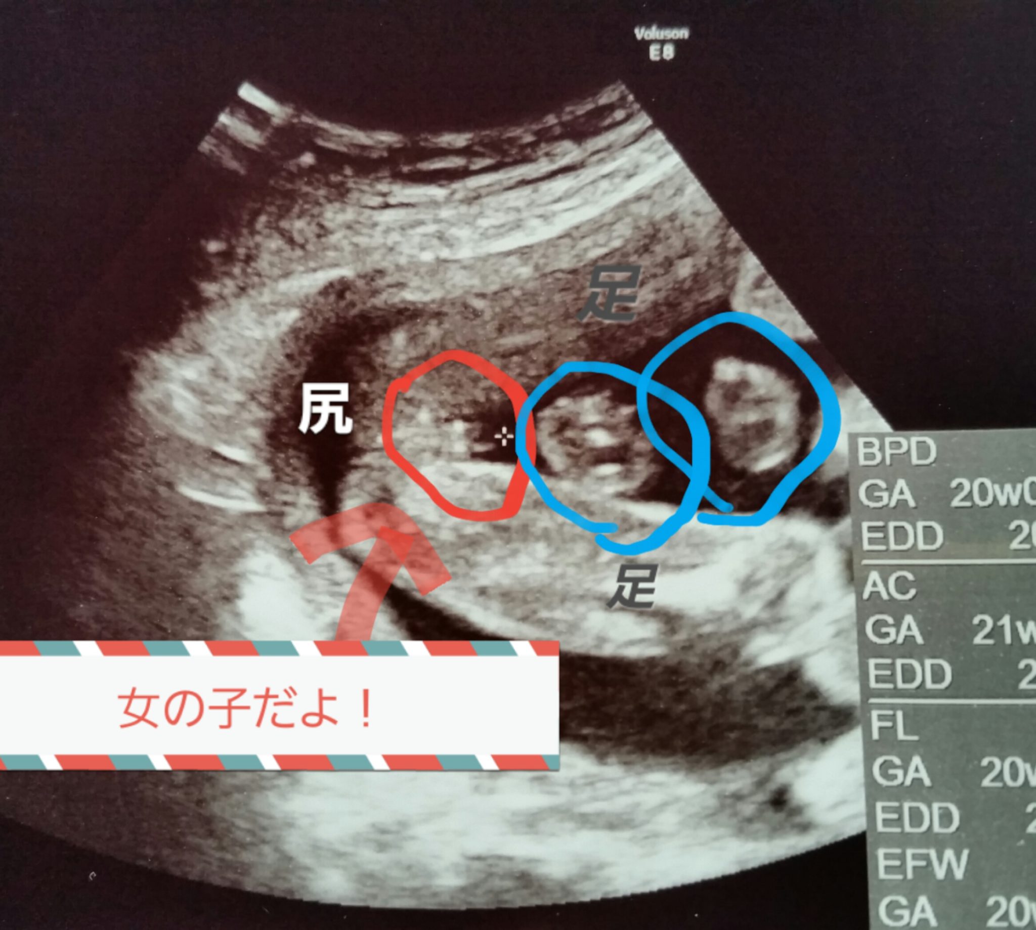 【2026年最新】「女の子を妊娠した時の特徴」は本当？つわり・お腹の形・最新Ai診断から紐解く噂と真実