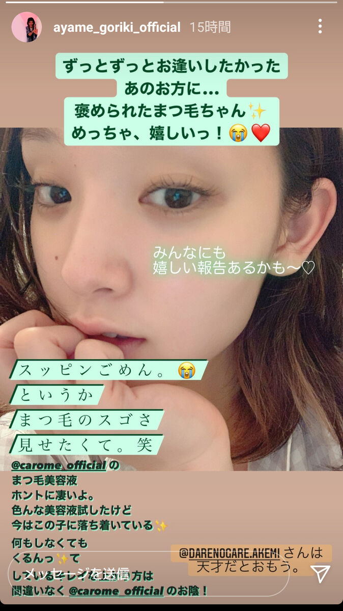 剛力彩芽のすっぴんが肌綺麗すぎ？別人噂と2026年最新美容法の真相