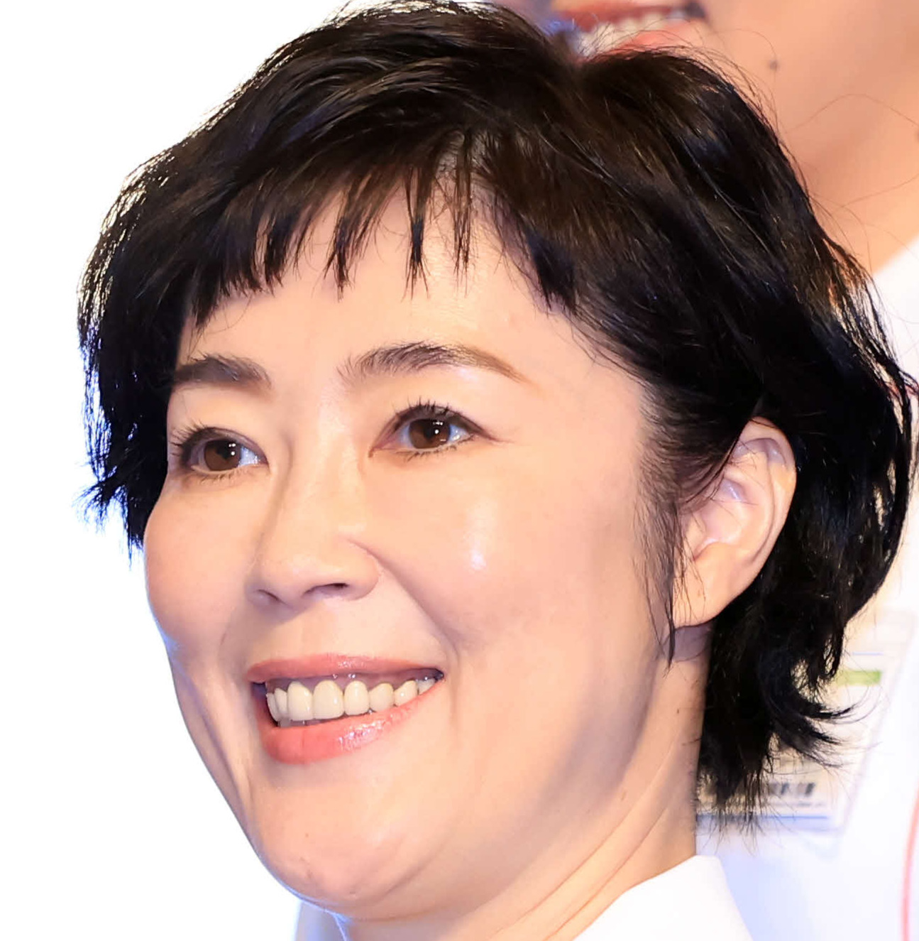 顔面神経麻痺を公表した芸能人の現在と闘病の真相【2026年最新】