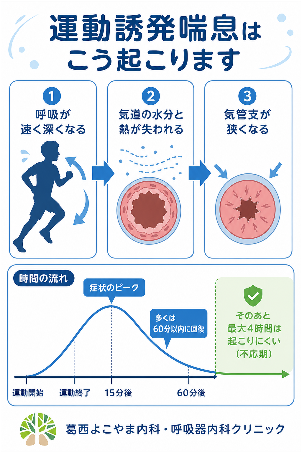 走ると咳が止まらない原因は？運動誘発性喘息の真実と最新治療法