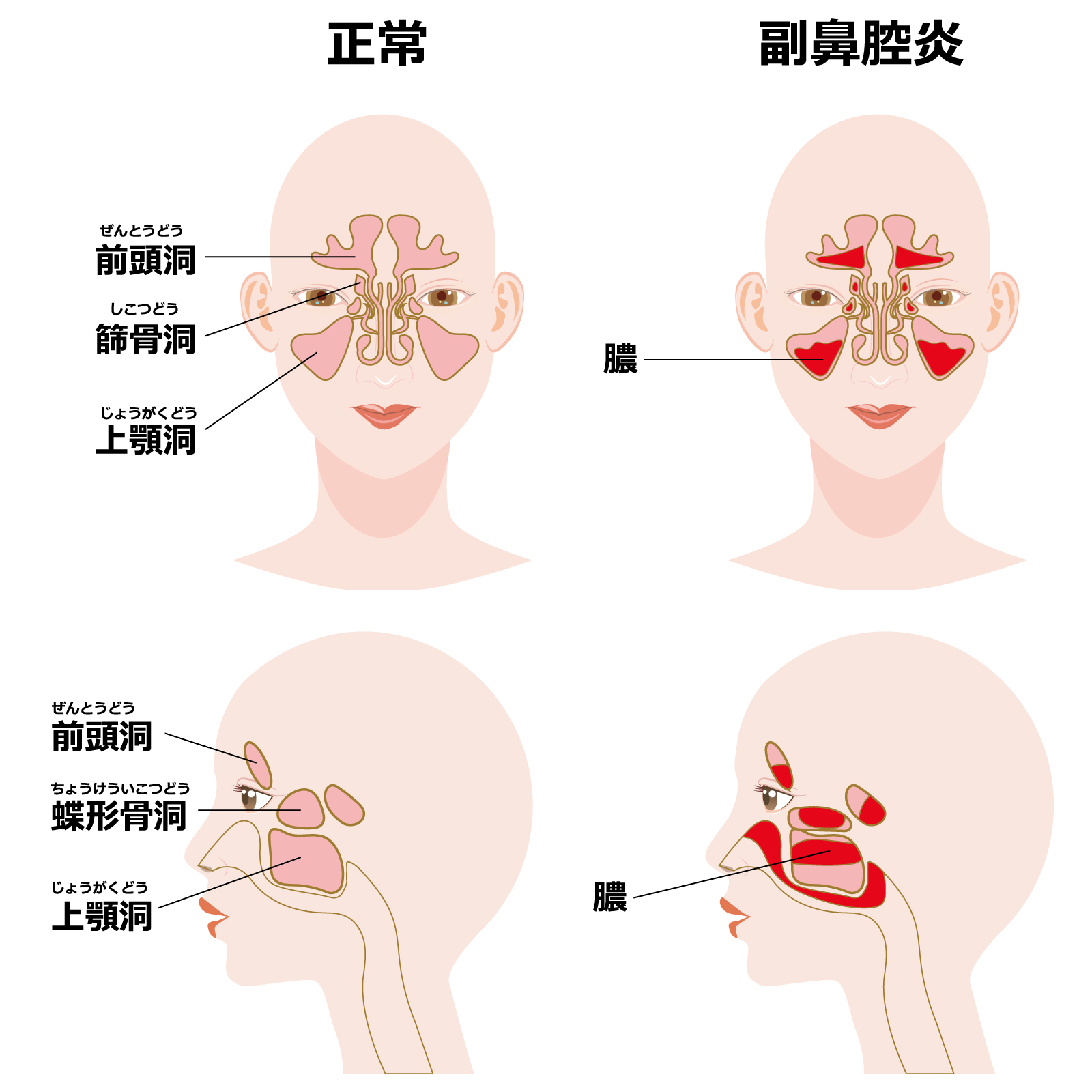 頬骨の下を押すと痛いのはなぜ？片側の違和感と危険な病気の見極め方