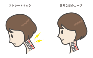 【速報】 ストレート ネック 治し 方 ためして ガッテン 気になる噂と真相 #745