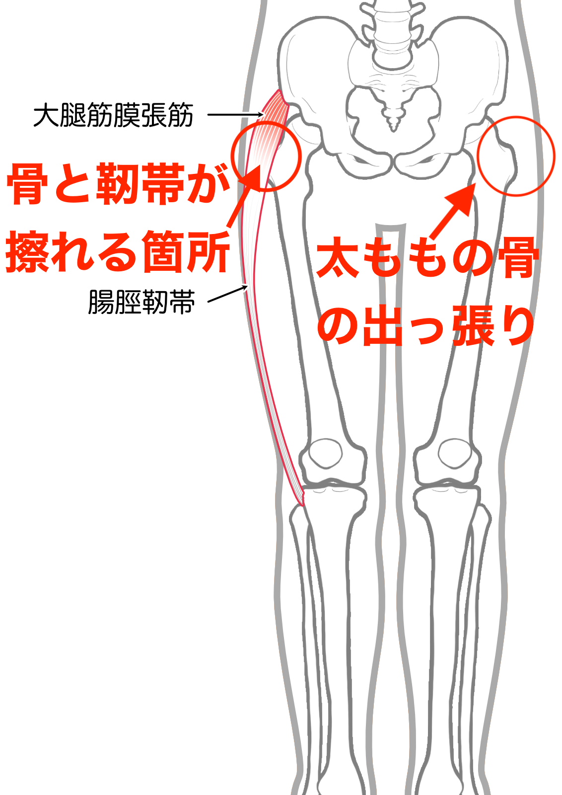 股関節が鳴る弾発股の治し方と原因！ポキポキ音の放置リスクと改善策