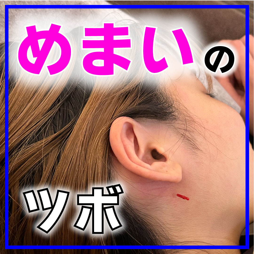 突然のめまいに効くツボ5選！即効で和らげる押し方と危険なサイン