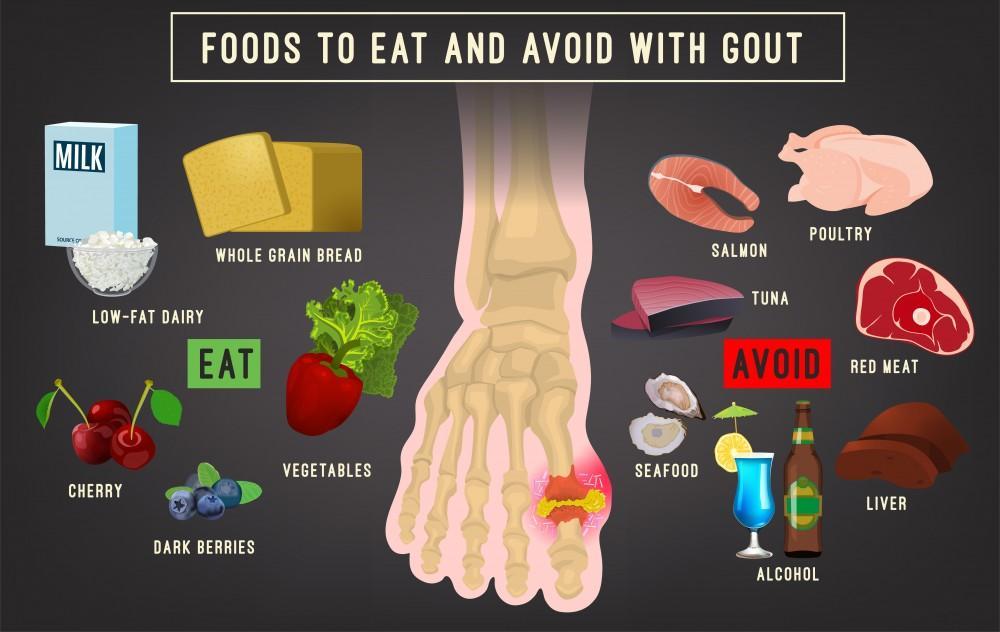 What Foods to Avoid Eating When You Have Gout
