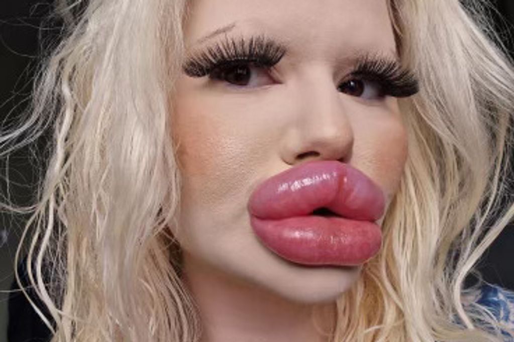 The Biggest Lips in the World