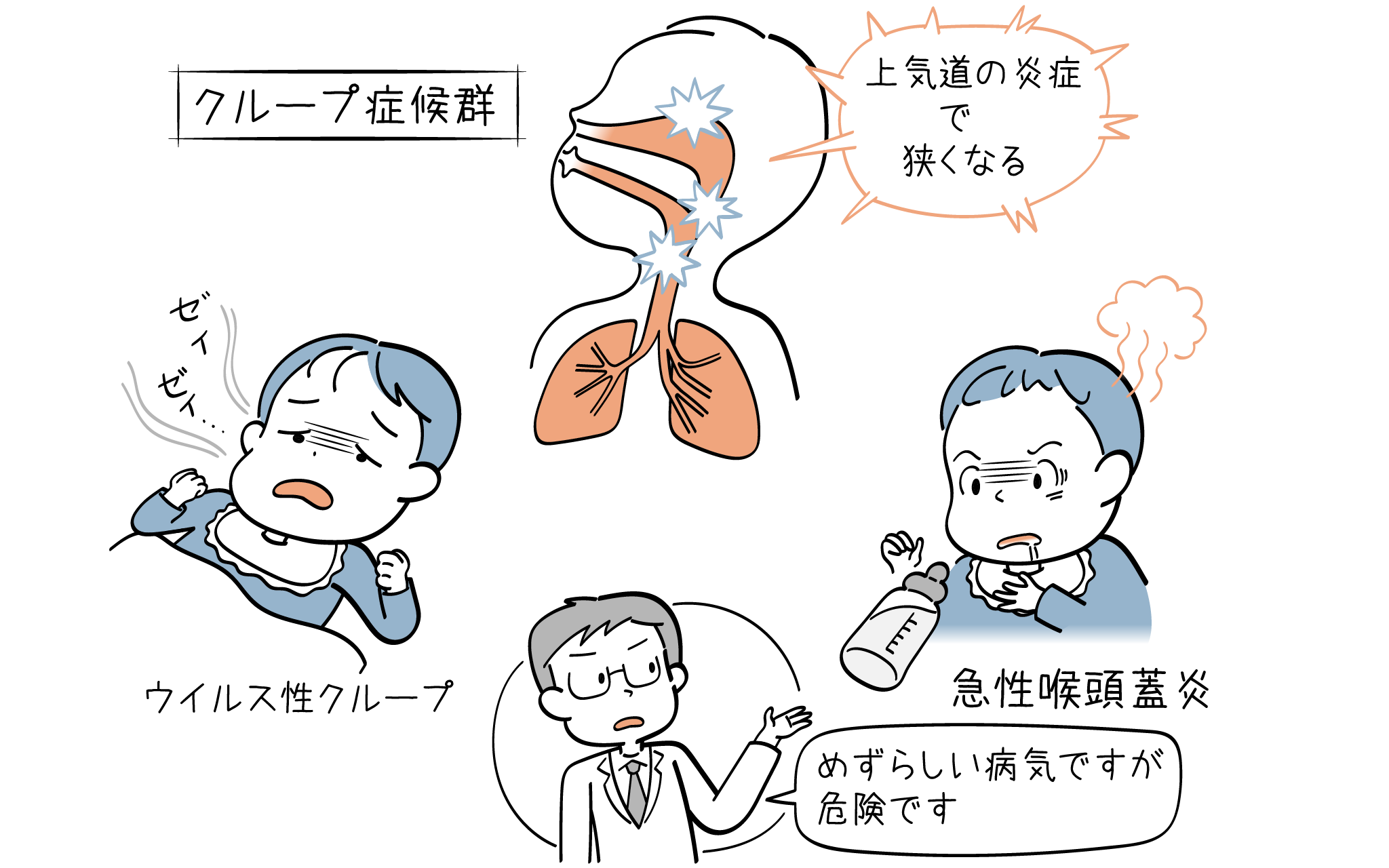 クループ症候群はうつる？兄弟や大人の感染リスクと登園基準を徹底解説
