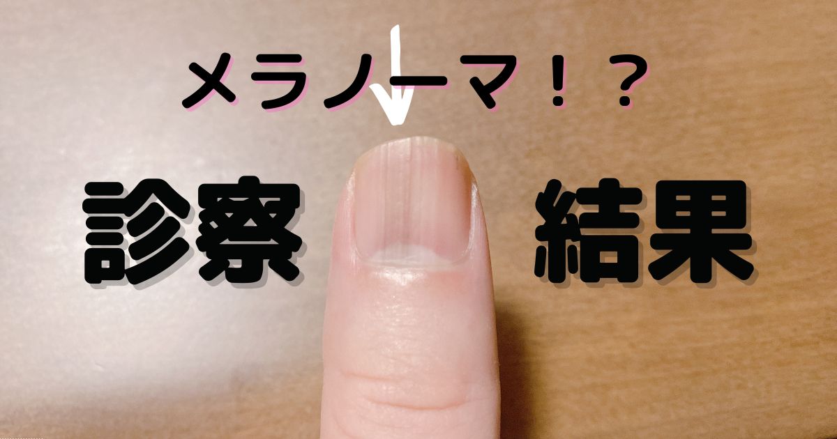 滋賀名物・赤こんにゃくの美味しい食べ方！赤い理由と人気レシピを解説