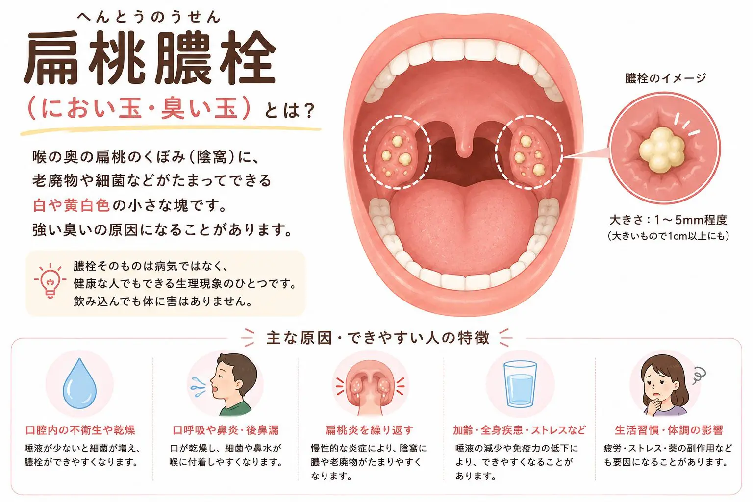 喉の奥が臭い原因とドブ臭さの正体！臭い玉の正しい取り方【2026最新】