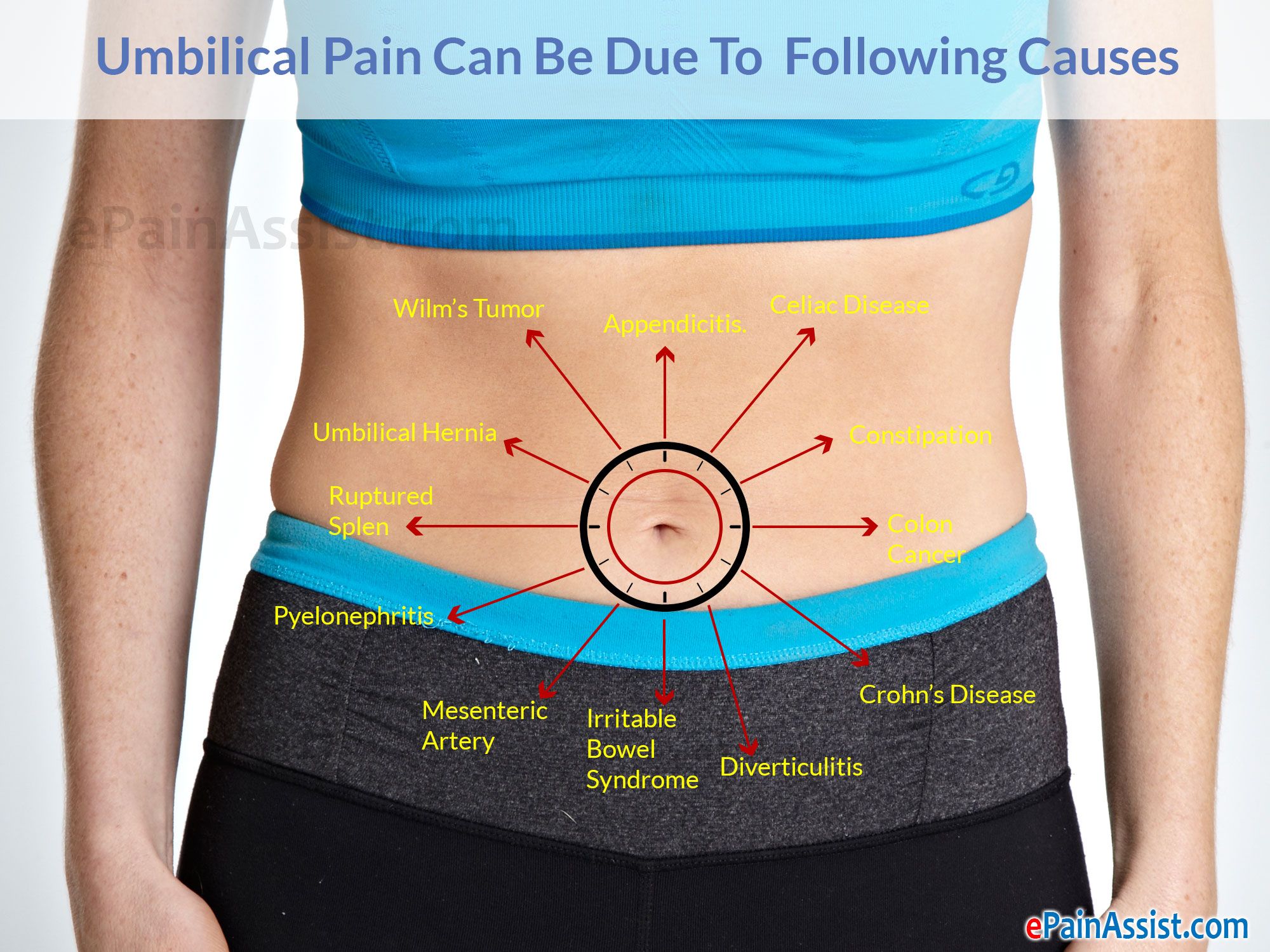 Pain Near Navel on Right Side