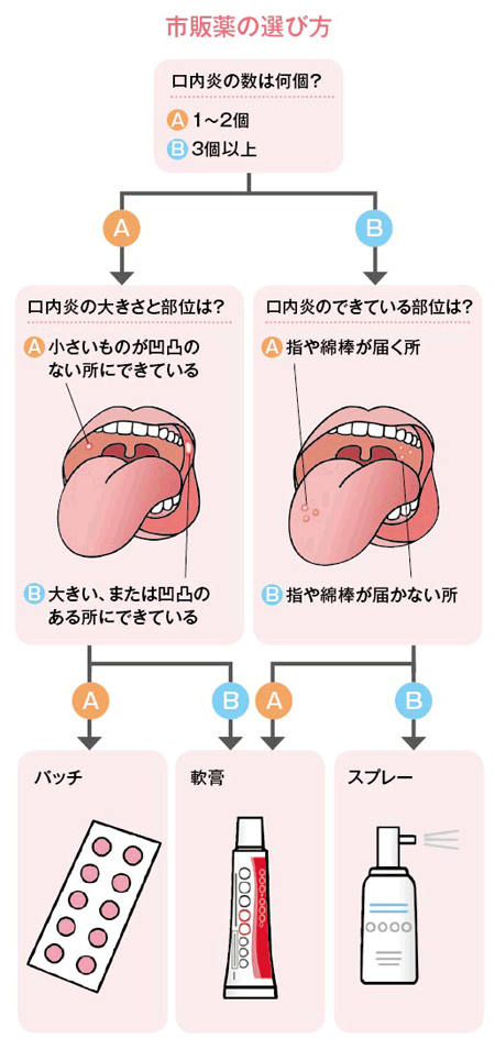 2026年最新【口内炎の即効ケア】激痛を最短で抑える科学的アプローチと噂の応急処置を検証