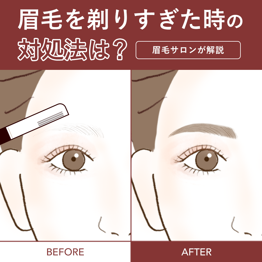 眉毛を剃りすぎた時の緊急対処！生える期間と最速リカバリー完全術
