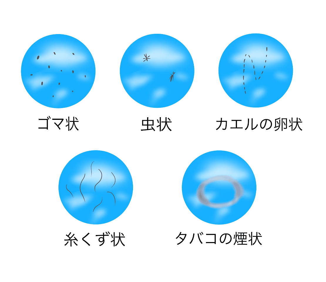 スマホ中に視界がピカピカ光る！光視症の正体と網膜剥離の危険性