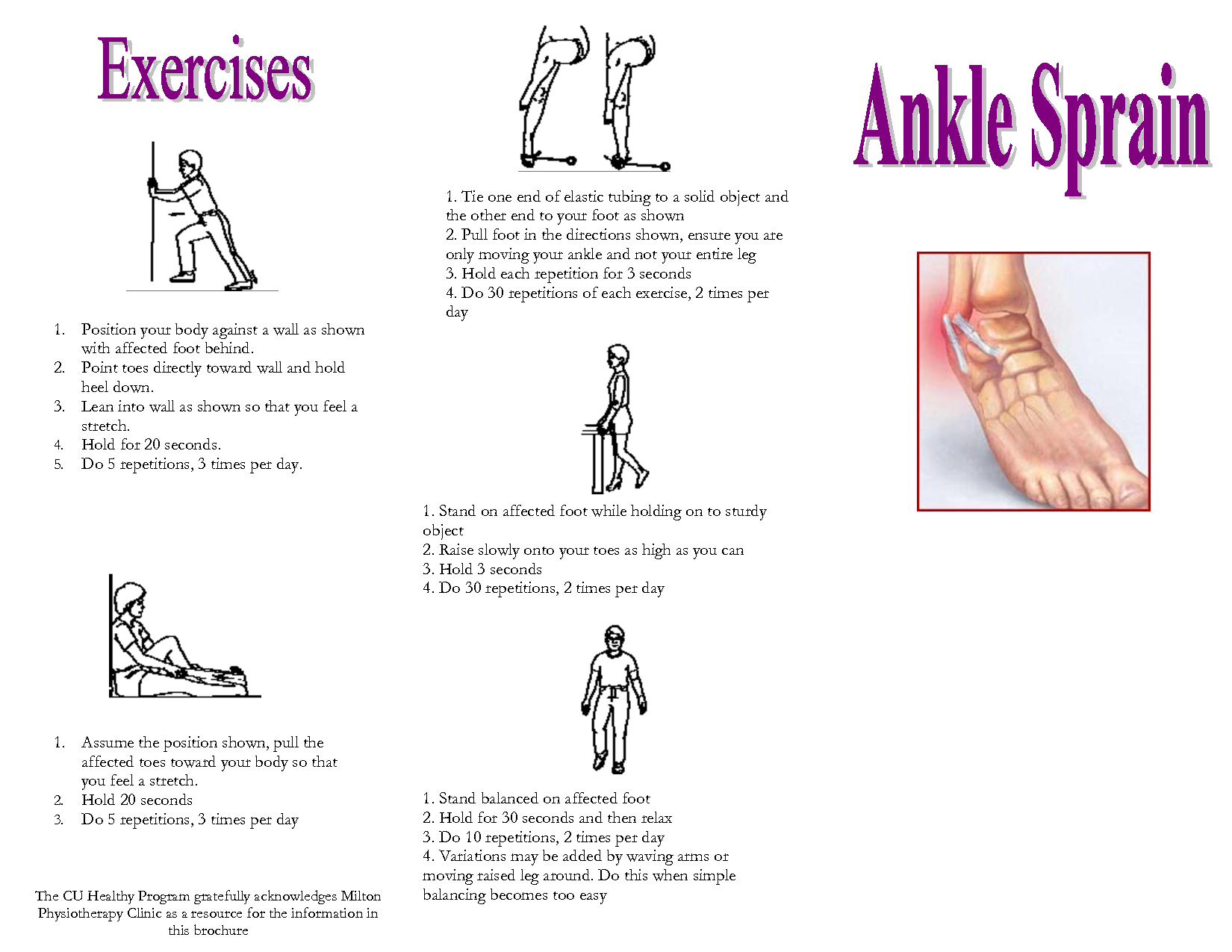 Physical Therapy Exercises for Sprained Ankle Pdf