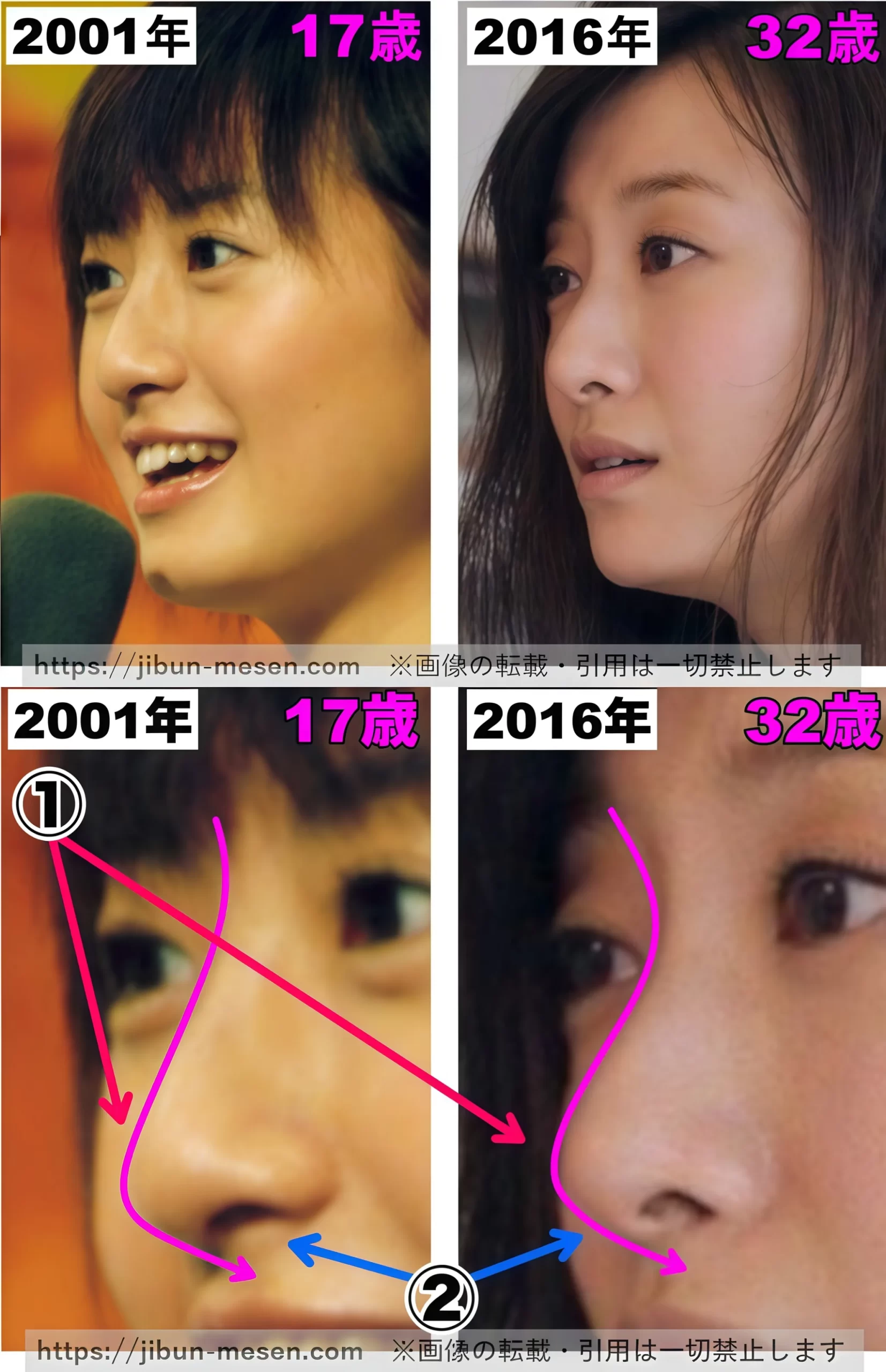 松本まりかの整形疑惑は本当？昔と現在の写真比較と顔が変わった真相