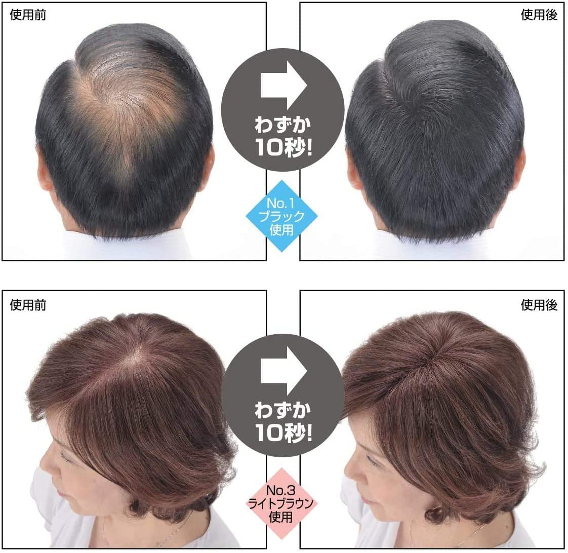 スーパーミリオンヘアーは本当にバレる？雨汗の耐久性と口コミ検証