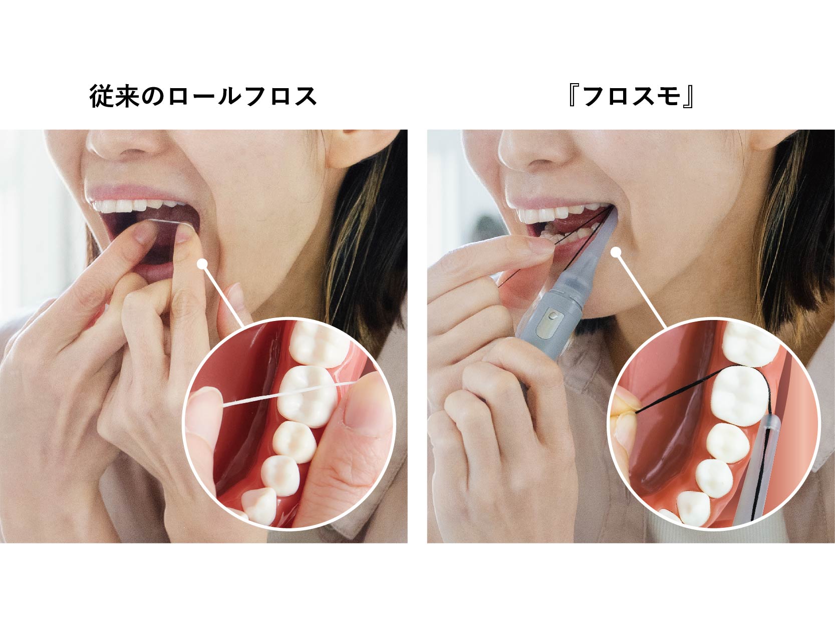 プロ直伝の正しい巻き方解剖！ロールフロスで極める最強歯垢ケア