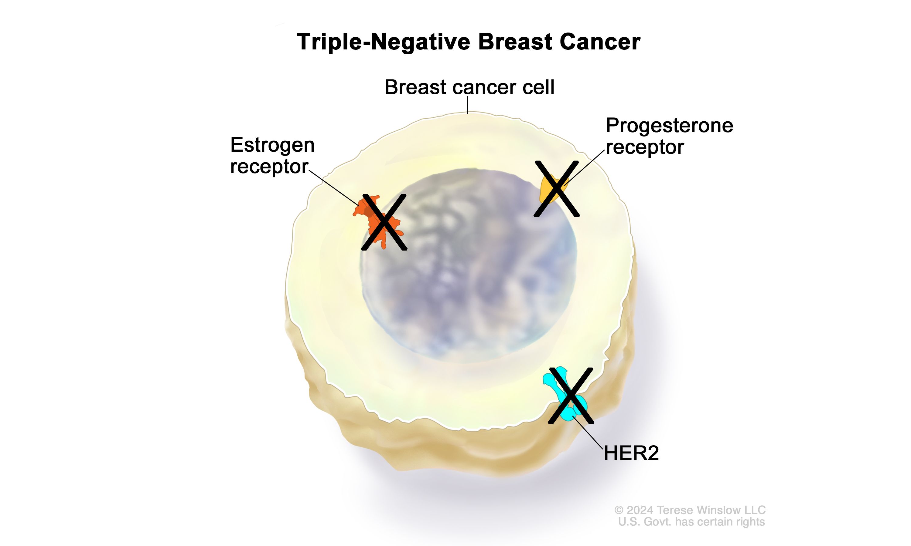 Breast Cancer and Triple Negative