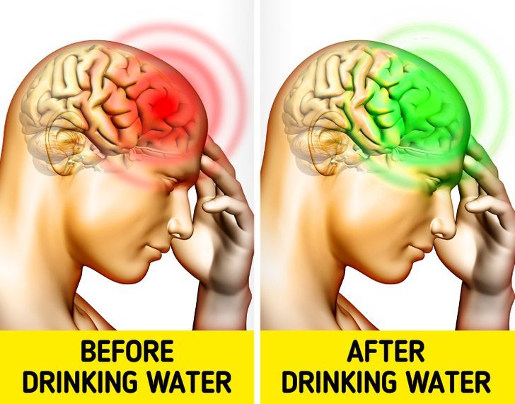 Not Drinking Enough Water Can Cause Headaches