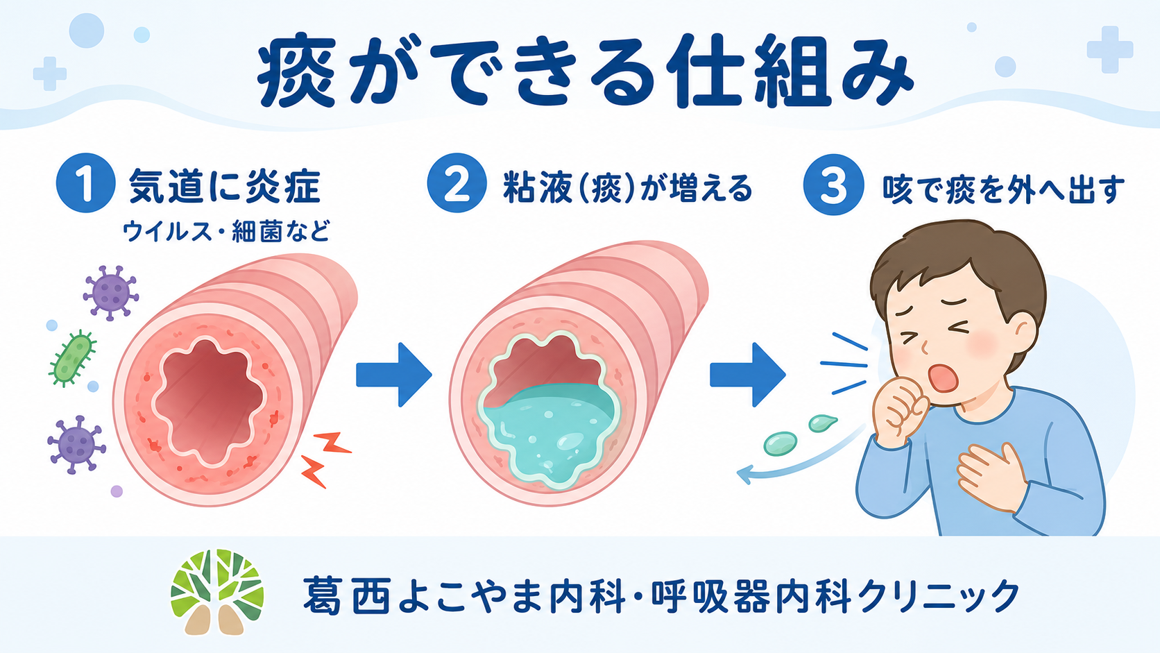 喉に痰が絡むのはなぜ？咳が出ない違和感の原因と正しい対処法