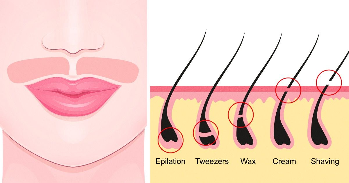 How Can I Get Rid of Chin Hair