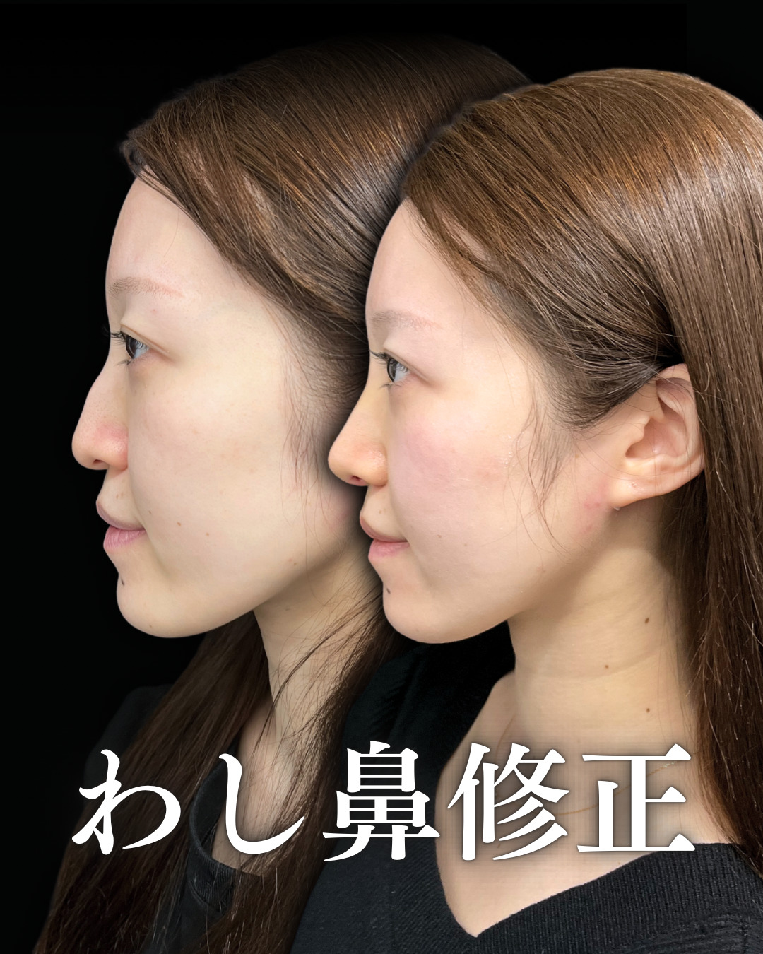 鷲鼻の女性が持つ唯一無二の気品。コンプレックスを魅惑の横顔へ