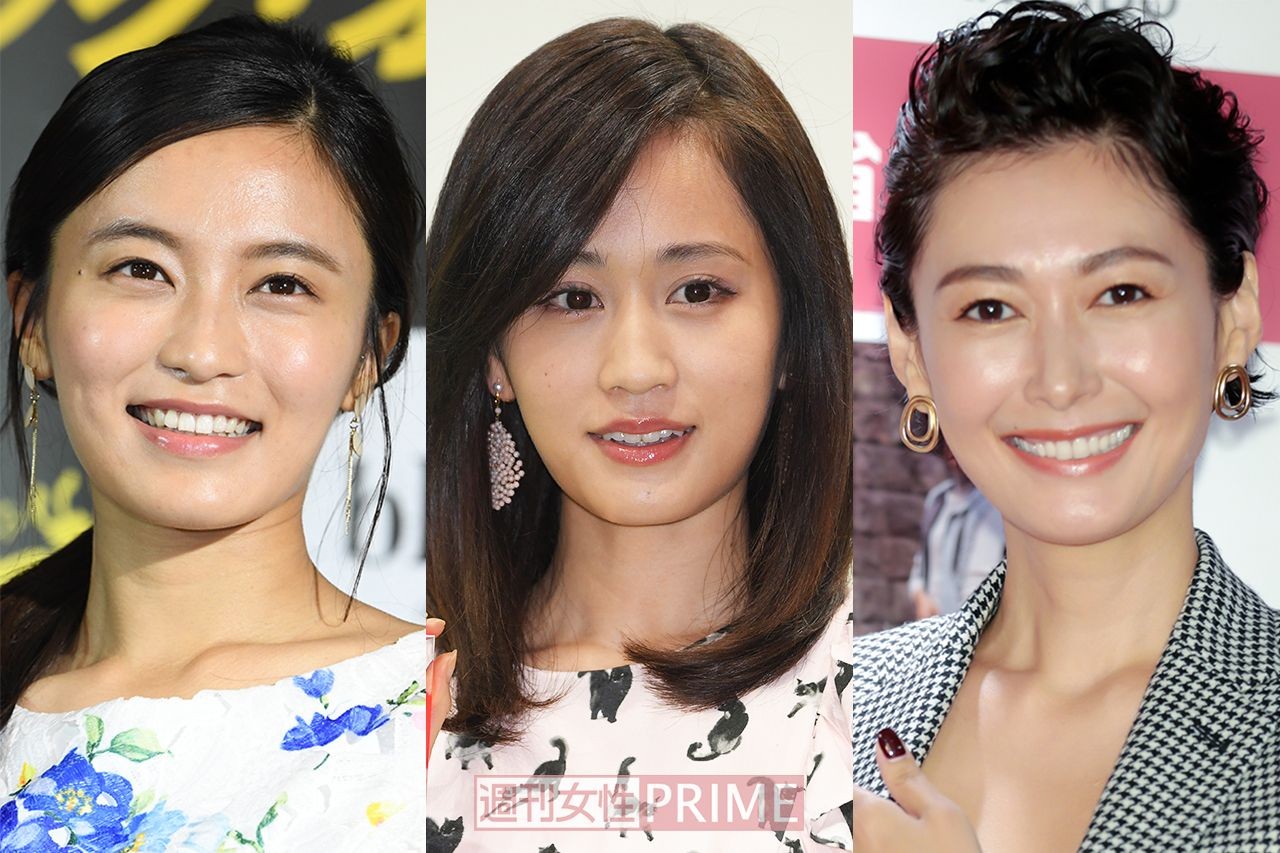ボトックスで顔が不自然な芸能人はなぜ？引きつりや失敗の真相と現在